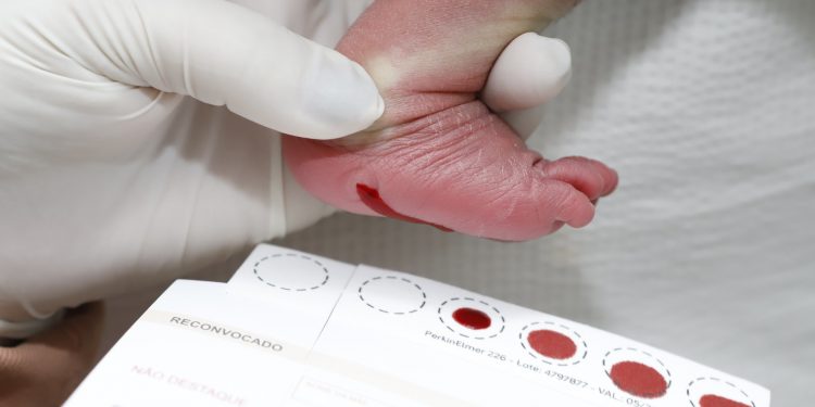 Dia Nacional do Teste do Pezinho: saiba onde fazer em Bauru e qual o prazo para o exame em recém-nascidos